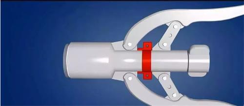 包皮切割吻合器注冊審查指導(dǎo)原則（2021年第102號）(圖1)