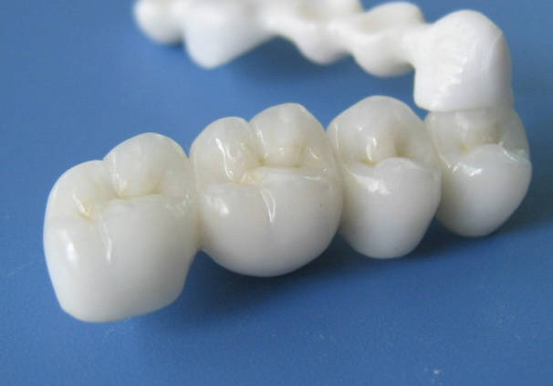 第Ⅱ類醫(yī)療器械“定制式義齒”產(chǎn)品的注冊申報(bào)資料要求及審評共性問題分享(圖1)