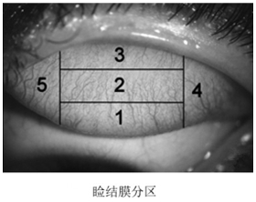 接觸鏡護理產(chǎn)品注冊審查指導(dǎo)原則（2023年修訂版）（2023年第9號）(圖7)