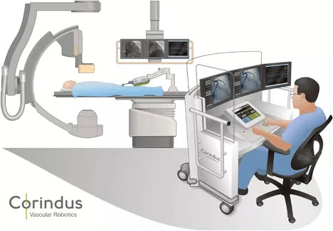血管腔內(nèi)介入手術機器人首例臨床試驗案例及未來發(fā)展方向(圖2)