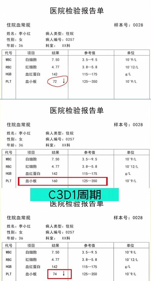 AE與研究藥物關(guān)系記錄不一致，如何處理？
