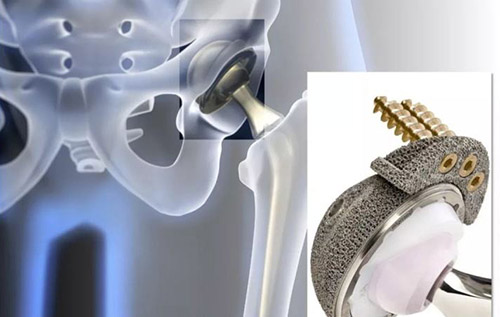 骨科金屬植入物有限元分析資料注冊技術(shù)審查指導(dǎo)原則（2020年第48號(hào)）(圖1)